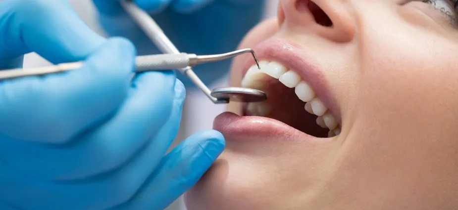 Root canal
