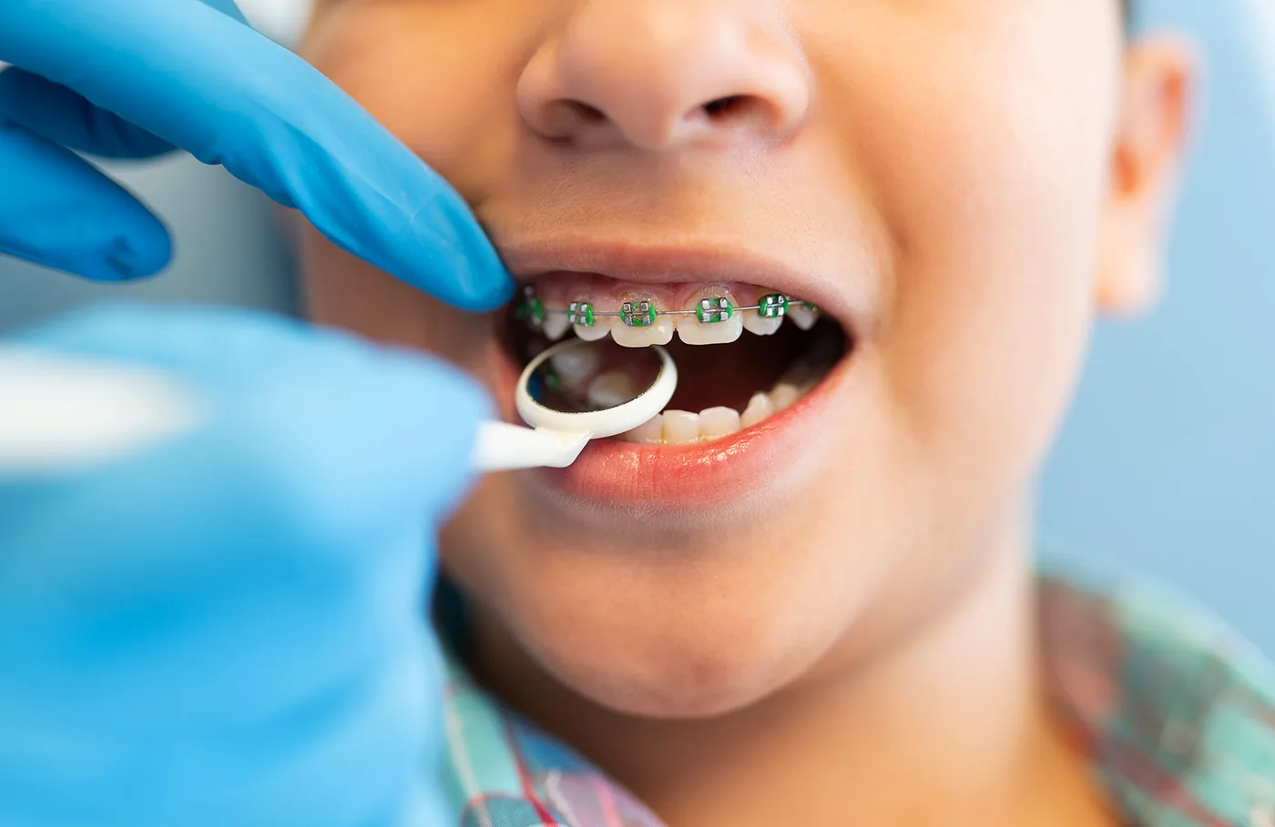 What is Kids and Teen Orthodontics?