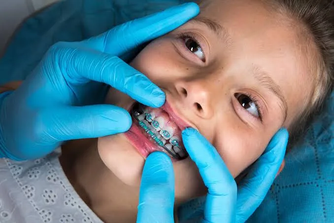 Kids and teen orthodontics