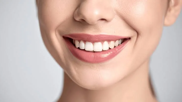 What is Smile Makeover?